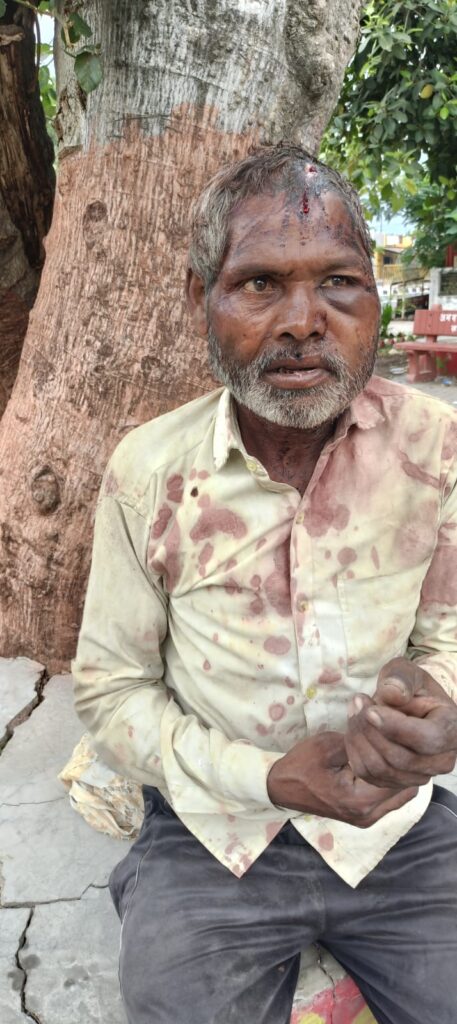 मुर्गा चोरी का आरोप लगाकर मजदूर की कर दी बेरहमी से पिटाई, सिर फटा, पुलिस जांच में जुटी
