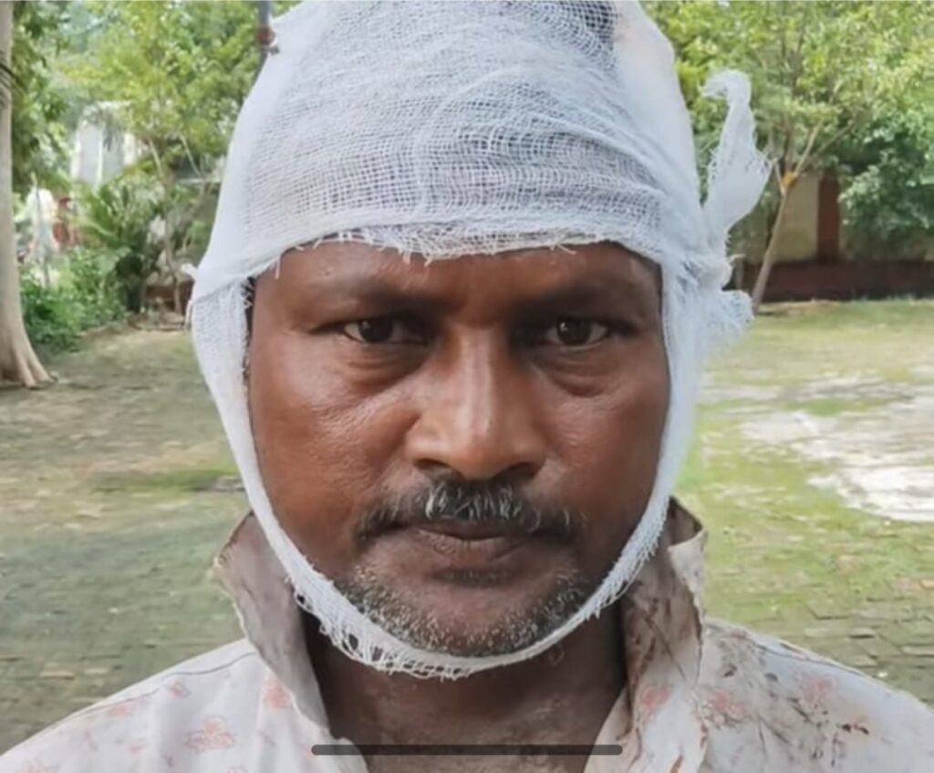 शराब के नशे में विवाद, चाकू और लाठी-डंडों से हमला , आधा दर्जन लोग घायल
